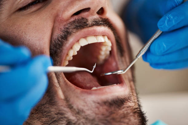 Best Weekend Emergency Dentist in Memphis, TX